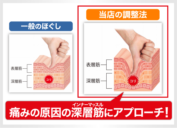 痛みの原因の深層筋にアプローチ！