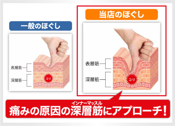 痛みの原因の深層筋にアプローチ！